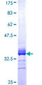 COL9A3 / Collagen IX Protein - 12.5% SDS-PAGE Stained with Coomassie Blue.