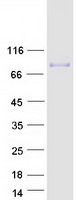 COL9A3 / Collagen IX Protein - Purified recombinant protein COL9A3 was analyzed by SDS-PAGE gel and Coomassie Blue Staining