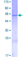 COLEC10 Protein - 12.5% SDS-PAGE of human COLEC10 stained with Coomassie Blue