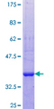 COLEC10 Protein - 12.5% SDS-PAGE Stained with Coomassie Blue.