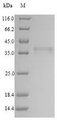 COLEC11 Protein - (Tris-Glycine gel) Discontinuous SDS-PAGE (reduced) with 5% enrichment gel and 15% separation gel.