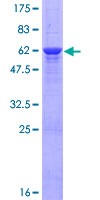 COLEC11 Protein - 12.5% SDS-PAGE of human COLEC11 stained with Coomassie Blue
