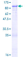 COLEC12 Protein - 12.5% SDS-PAGE of human COLEC12 stained with Coomassie Blue
