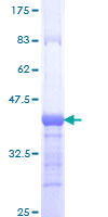 COLEC12 Protein - 12.5% SDS-PAGE Stained with Coomassie Blue.