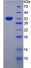 Collagen VII Protein - Recombinant Collagen Type VII By SDS-PAGE