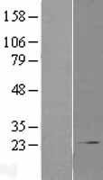 COMMD1 Protein - Western validation with an anti-DDK antibody * L: Control HEK293 lysate R: Over-expression lysate