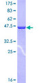 COMMD1 Protein - 12.5% SDS-PAGE of human COMMD1 stained with Coomassie Blue