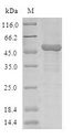 COMMD1 Protein - (Tris-Glycine gel) Discontinuous SDS-PAGE (reduced) with 5% enrichment gel and 15% separation gel.