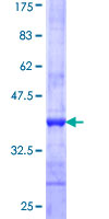 COMMD1 Protein - 12.5% SDS-PAGE Stained with Coomassie Blue.