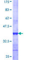 COMMD1 Protein - 12.5% SDS-PAGE Stained with Coomassie Blue.