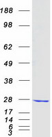 COMMD1 Protein - Purified recombinant protein COMMD1 was analyzed by SDS-PAGE gel and Coomassie Blue Staining