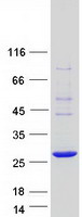 COMMD10 Protein - Purified recombinant protein COMMD10 was analyzed by SDS-PAGE gel and Coomassie Blue Staining
