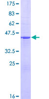 COMMD2 Protein - 12.5% SDS-PAGE of human COMMD2 stained with Coomassie Blue