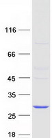COMMD2 Protein - Purified recombinant protein COMMD2 was analyzed by SDS-PAGE gel and Coomassie Blue Staining