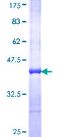 COMMD3 / BUP Protein - 12.5% SDS-PAGE Stained with Coomassie Blue.