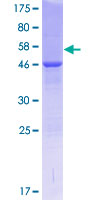 COMMD4 Protein - 12.5% SDS-PAGE of human COMMD4 stained with Coomassie Blue