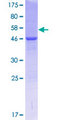 COMMD4 Protein - 12.5% SDS-PAGE of human COMMD4 stained with Coomassie Blue