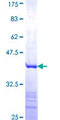 COMMD5 Protein - 12.5% SDS-PAGE Stained with Coomassie Blue.