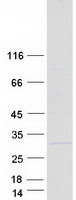 COMMD5 Protein - Purified recombinant protein COMMD5 was analyzed by SDS-PAGE gel and Coomassie Blue Staining