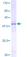 COMMD7 Protein - 12.5% SDS-PAGE of human COMMD7 stained with Coomassie Blue