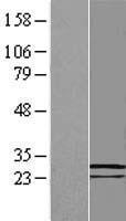 COMMD8 Protein - Western validation with an anti-DDK antibody * L: Control HEK293 lysate R: Over-expression lysate