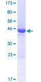 COMMD8 Protein - 12.5% SDS-PAGE of human COMMD8 stained with Coomassie Blue