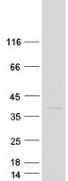 COMMD8 Protein - Purified recombinant protein COMMD8 was analyzed by SDS-PAGE gel and Coomassie Blue Staining