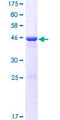 COMMD9 Protein - 12.5% SDS-PAGE of human COMMD9 stained with Coomassie Blue