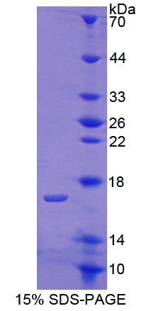 COMP / THBS5 Protein - Recombinant  Cartilage Oligomeric Matrix Protein By SDS-PAGE