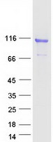 COMP / THBS5 Protein - Purified recombinant protein COMP was analyzed by SDS-PAGE gel and Coomassie Blue Staining