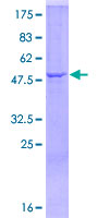 Complement C1QA Protein - 12.5% SDS-PAGE of human C1QA stained with Coomassie Blue