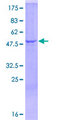 Complement C1QA Protein - 12.5% SDS-PAGE of human C1QA stained with Coomassie Blue