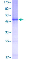 Complement C1QB Protein - 12.5% SDS-PAGE of human C1QB stained with Coomassie Blue
