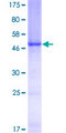 Complement C1QB Protein - 12.5% SDS-PAGE of human C1QB stained with Coomassie Blue
