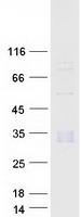 Complement C1QB Protein - Purified recombinant protein C1QB was analyzed by SDS-PAGE gel and Coomassie Blue Staining