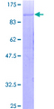 Complement C1R Protein - 12.5% SDS-PAGE of human C1R stained with Coomassie Blue
