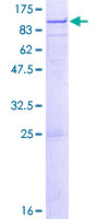 Complement C1R Protein - 12.5% SDS-PAGE of human C1R stained with Coomassie Blue