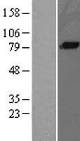 Complement C1s Protein - Western validation with an anti-DDK antibody * L: Control HEK293 lysate R: Over-expression lysate