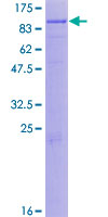 Complement C1s Protein - 12.5% SDS-PAGE of human C1S stained with Coomassie Blue