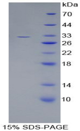 Complement C1s Protein - Recombinant Complement Component 1, S Subcomponent By SDS-PAGE