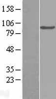 Complement C2 Protein - Western validation with an anti-DDK antibody * L: Control HEK293 lysate R: Over-expression lysate