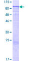 Complement C2 Protein - 12.5% SDS-PAGE of human C2 stained with Coomassie Blue