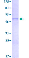 Complement C2 Protein - 12.5% SDS-PAGE Stained with Coomassie Blue.