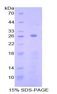 Complement C2 Protein - Recombinant Complement Component 2 By SDS-PAGE