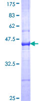 Complement C3 Protein - 12.5% SDS-PAGE Stained with Coomassie Blue.