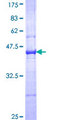 Complement C3 Protein - 12.5% SDS-PAGE Stained with Coomassie Blue.