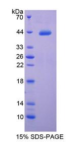 Complement C4 Protein - Recombinant Complement Component 4 By SDS-PAGE