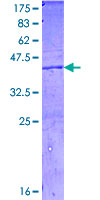 Complement C4a Protein - 12.5% SDS-PAGE Stained with Coomassie Blue.