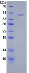 Complement C4a Protein - Recombinant Complement Component 4a By SDS-PAGE
