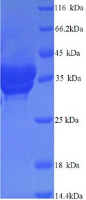 Complement C4b Protein